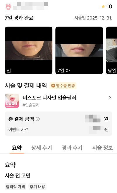 강남언니 후기 10,000건 병원이 말하는, 후기 숫자를 볼 때 꼭 봐야 할 기준 사진 5
