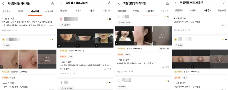강남언니 후기 10,000건 병원이 말하는, 후기 숫자를 볼 때 꼭 봐야 할 기준