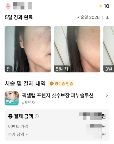 강남언니 후기 10,000건 병원이 말하는, 후기 숫자를 볼 때 꼭 봐야 할 기준 사진 13