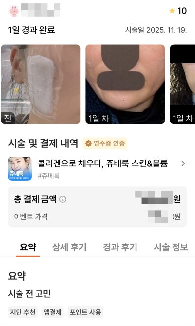 강남언니 후기 10,000건 병원이 말하는, 후기 숫자를 볼 때 꼭 봐야 할 기준 사진 11