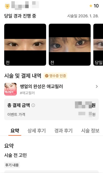 강남언니 후기 10,000건 병원이 말하는, 후기 숫자를 볼 때 꼭 봐야 할 기준 사진 7
