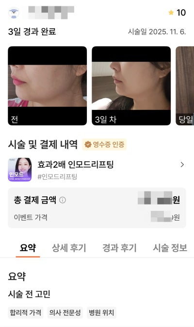 강남언니 후기 10,000건 병원이 말하는, 후기 숫자를 볼 때 꼭 봐야 할 기준 사진 9