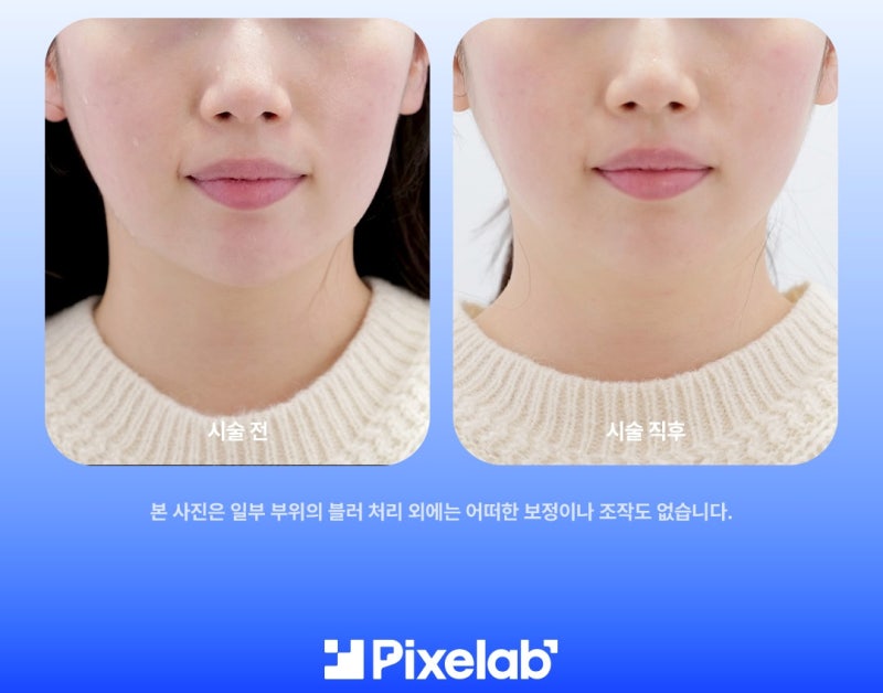 덴서티 알파팁, 클래식·하이팁과의 차이점 3가지 - 알파 엠버서더가 설명드립니다! 사진 10