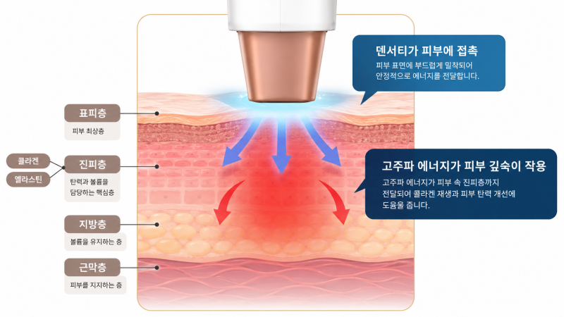 덴서티 알파팁, 클래식·하이팁과의 차이점 3가지 - 알파 엠버서더가 설명드립니다!