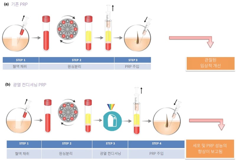 MCT 줄기세포, 배양 없이 당일 시술 가능? 줄기세포와 메타셀 차이점 3가지 사진 8