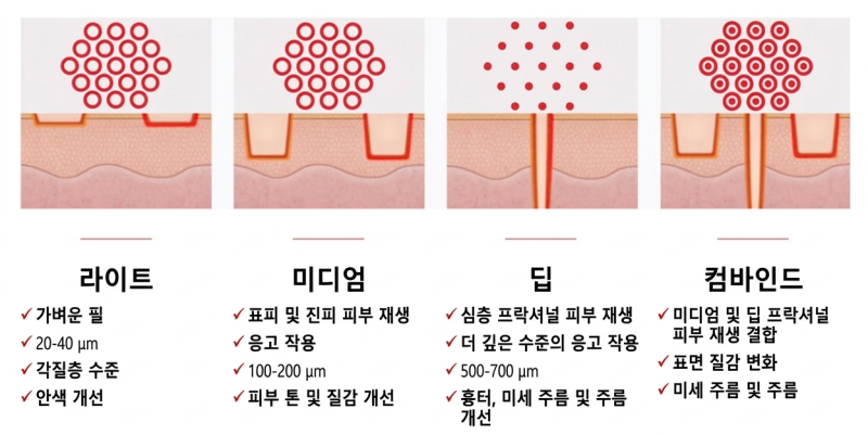 피부결·모공·흉터 고민이라면? 울트라펄스 알파로 한 번에 해결하세요! 사진 2