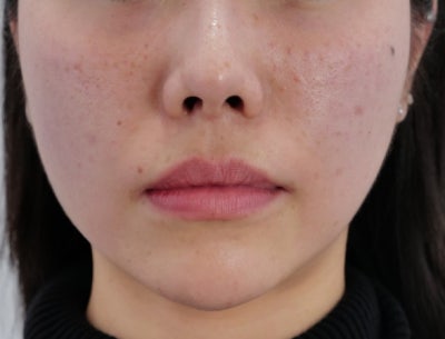 신논현 포텐자 주기, '한 달에 한 번'이 정답이 아닌 이유 사진 8