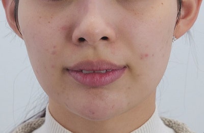신논현 포텐자 주기, '한 달에 한 번'이 정답이 아닌 이유 사진 3