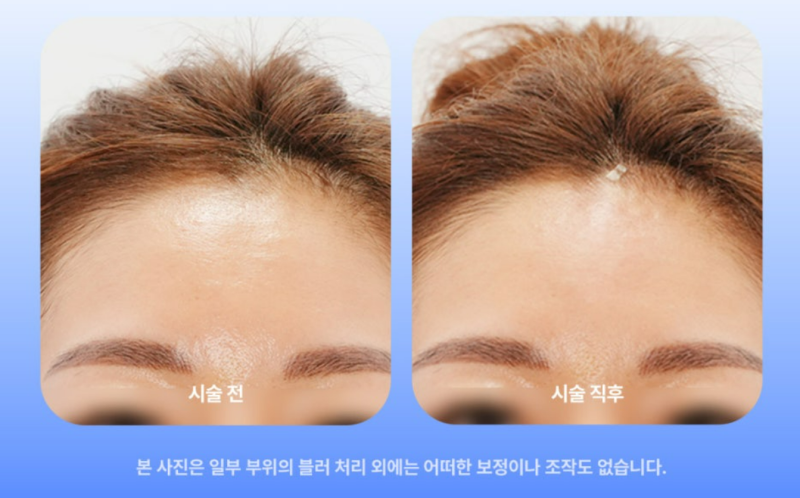 힐로웨이브 쥬베룩 비교, 결과가 2% 아쉬운 2가지 이유 사진 7