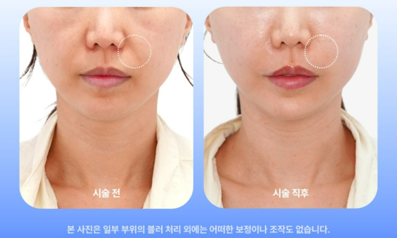 힐로웨이브 쥬베룩 비교, 결과가 2% 아쉬운 2가지 이유 사진 8