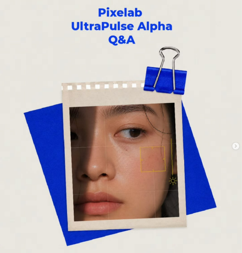 울트라펄스 다운타임 얼마나 걸리나요? 깊은 여드름흉터라면 꼭 체크하세요 사진 17
