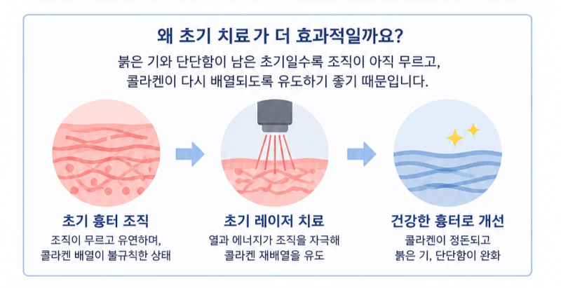 오래된 흉터도 좋아질까? 흉터 레이저 치료 골든타임 사진 3