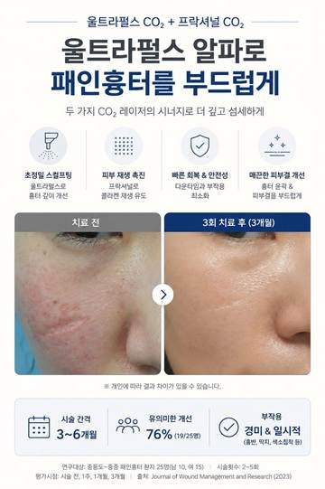 패인흉터 레이저 울트라펄스 알파, 기존 흉터 레이저랑 뭐가 다른 걸까요? 사진 8