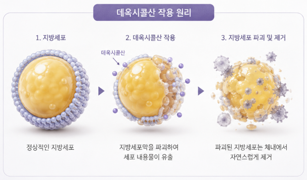 지방분해주사성분 총정리 | 데옥시콜산·스테로이드 차이와 하루핏 선택 기준 사진 6