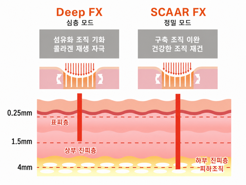 여드름 흉터 피부과, 후회 없이 선택하려면 확인해야 할 3가지 사진 5