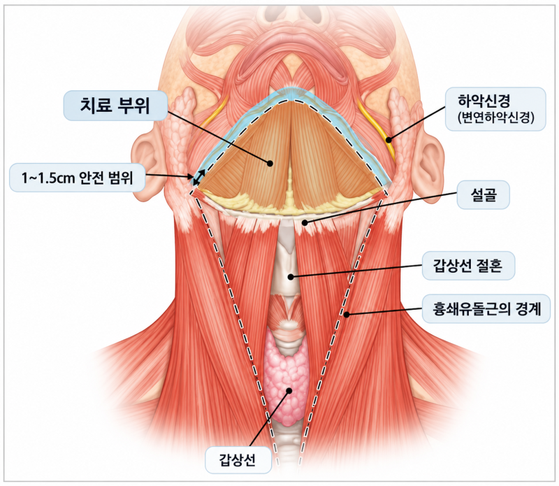 지방분해주사 성분, “스테로이드”만 확인하면 될까요? 사진 9