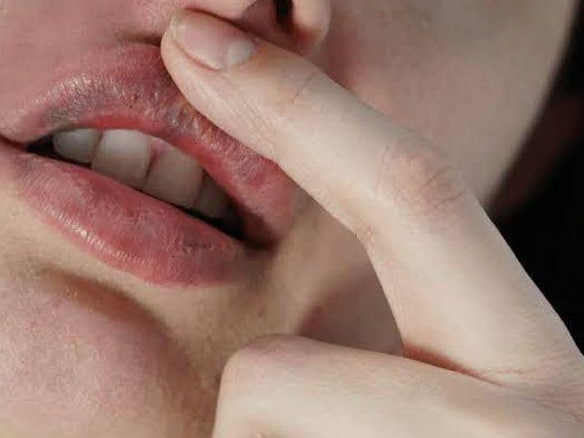 입술필러 부작용 줄이려면? 현직 성형외과 전문의의 5가지 경고 사진 8